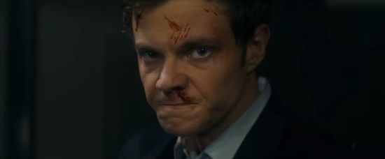 Closeup of Jack Quaid's face glaring and bleeding.